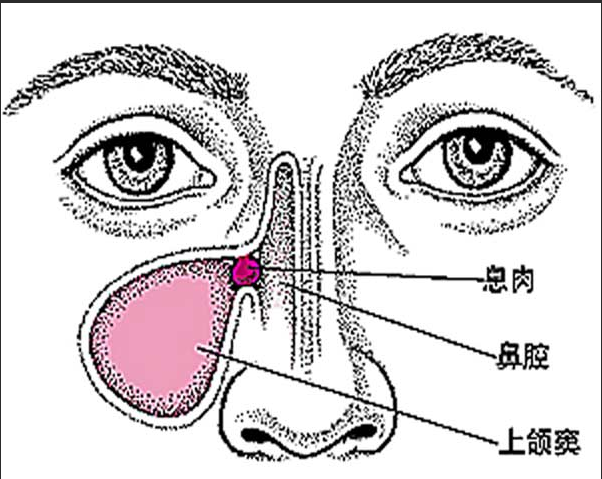 重庆耳鼻喉科医院排名